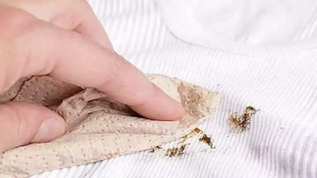 Kan Lekesi Yatakta Nasıl Çıkar