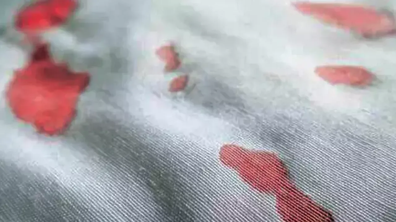 Kan Lekesi Yatakta Nasıl Çıkar